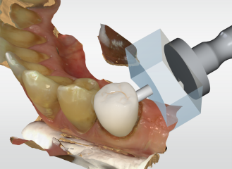 CEREC Primescan